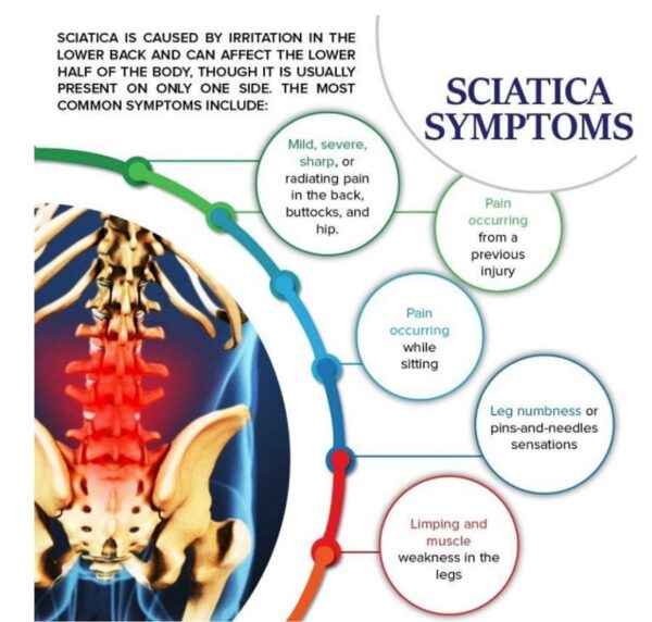 SCIATICA – NERVE PAIN – 240 Capsules – Turmeric + Bee Venom arthritis ...