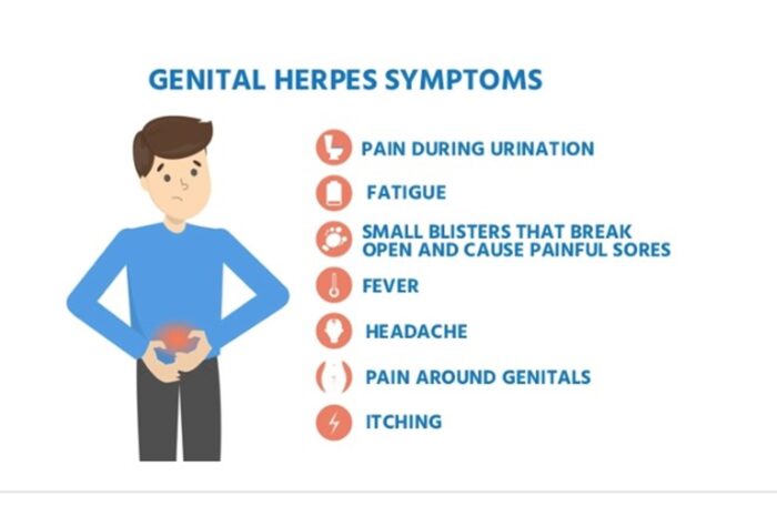 GENITAL HERPES 1 & 2 PAIN RELIEF - EXTRA STRENGTH - 120 Caps - MADE IN USA - Image 3