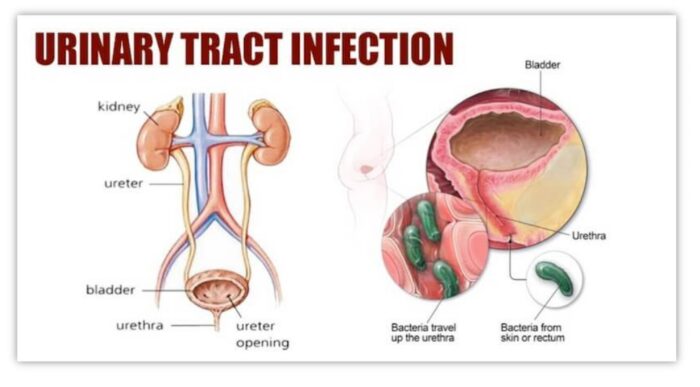 URINARY TRACT INFECTION - UTIs - MEN & WOMEN - TREAT & PREVENT - 60 GUMMIES - Image 5