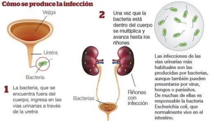 URINARY TRACT INFECTION - UTIs - MEN & WOMEN - TREAT & PREVENT - 60 GUMMIES - Image 8